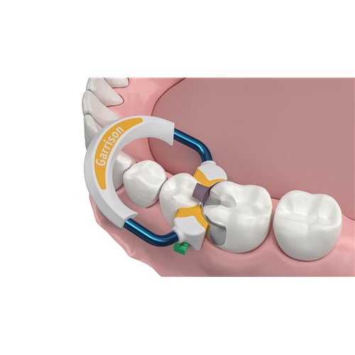 large-SG500 RingOnTeeth-O